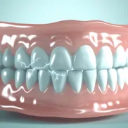 Bruxismus